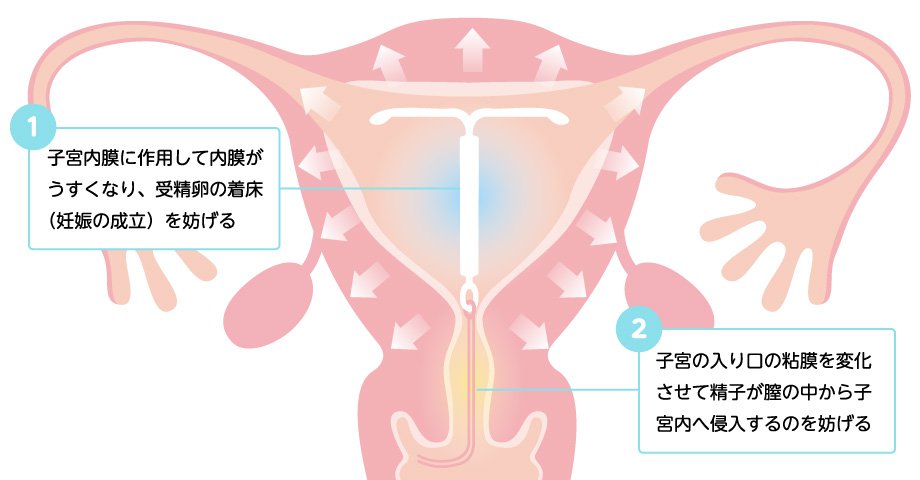 効果1：避妊効果