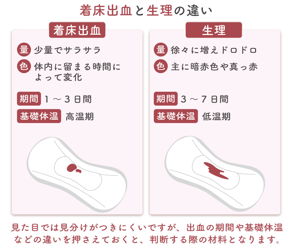 着床出血と生理の違い