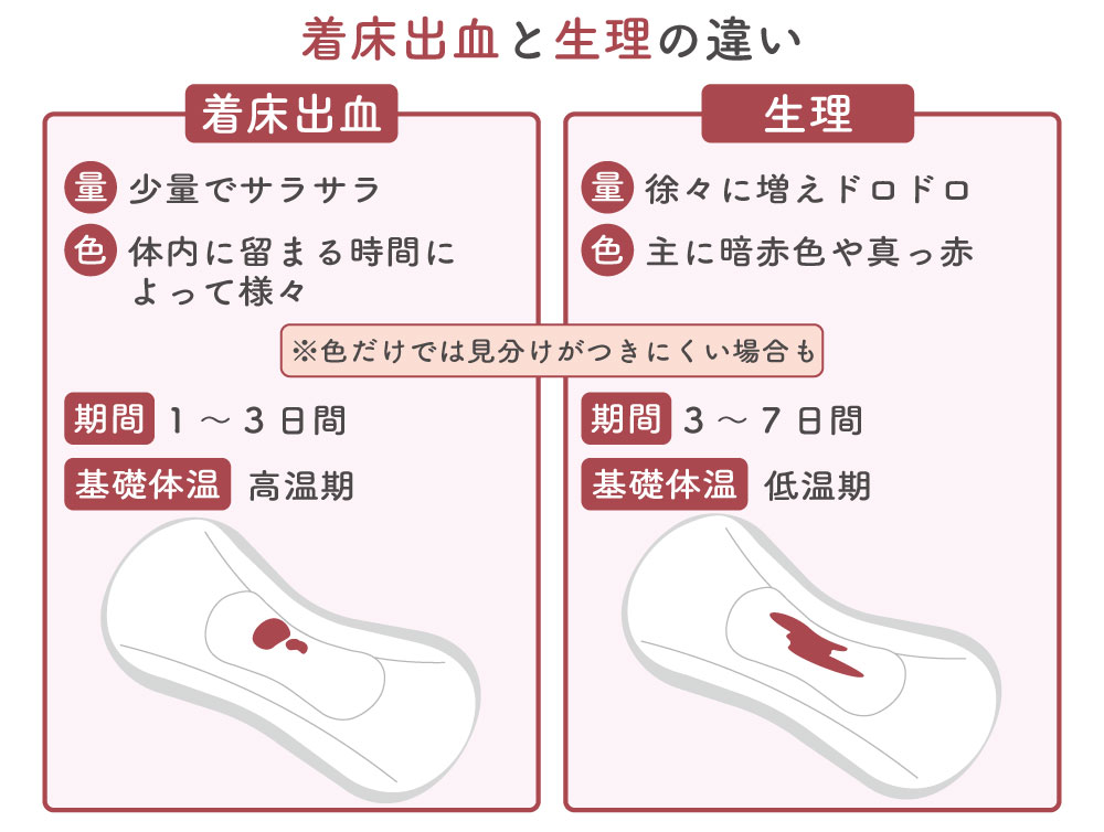 着床出血と生理の違い