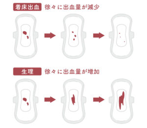着 床 出血 体験 談