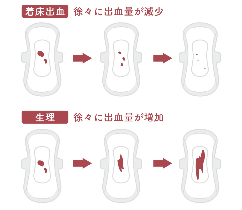 着床出血と生理の出血量の違い