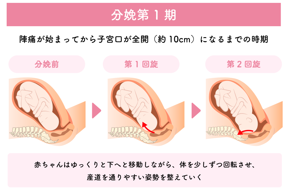 分娩第1期（開口期）