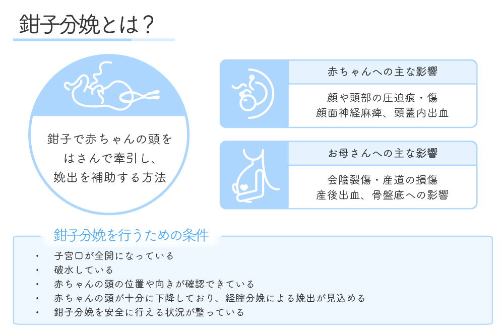 鉗子分娩とは?